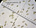 Inocybe lacera var.helobia-amf1012-spores